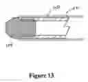 Fig. 14 - Cement-directing orthopedic implants