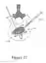 Fig. 18 - Cement-directing orthopedic implants