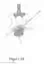 Fig. 19 - Cement-directing orthopedic implants