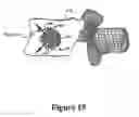 Fig. 20 - Cement-directing orthopedic implants