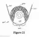 Fig. 22 - Cement-directing orthopedic implants