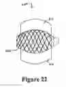 Fig. 23 - Cement-directing orthopedic implants