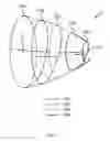 Fig. 04 - System, device and method for ablation of a vessel's wall from the inside