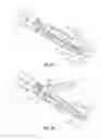 Fig. 03 - Electrosurgical instrument