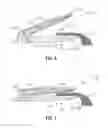 Fig. 05 - Electrosurgical instrument