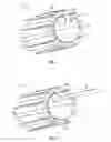 Fig. 05 - Basket catheter with an improved seal