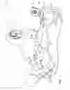 Fig. 02 - ABLATING AND SENSING ELECTRODES