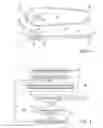 Fig. 04 - ABLATING AND SENSING ELECTRODES