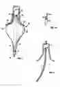 Fig. 02 - Guided cardiac ablation catheters