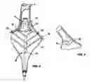 Fig. 04 - Guided cardiac ablation catheters