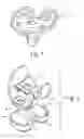 Fig. 02 - Method of designing orthopedic implants using in vivo data