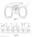 Fig. 12 - Method of designing orthopedic implants using in vivo data
