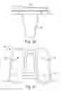 Fig. 15 - Method of designing orthopedic implants using in vivo data