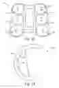 Fig. 16 - Method of designing orthopedic implants using in vivo data