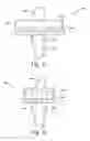 Fig. 20 - Method of designing orthopedic implants using in vivo data