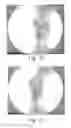 Fig. 22 - Method of designing orthopedic implants using in vivo data