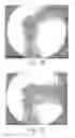 Fig. 23 - Method of designing orthopedic implants using in vivo data