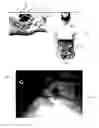 Fig. 01 - Surgical Targeting Systems and Methods
