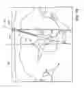 Fig. 12 - Surgical Targeting Systems and Methods