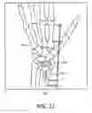 Fig. 16 - Surgical Targeting Systems and Methods