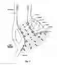 Fig. 06 - SYSTEMS AND METHODS FOR TREATING TISSUE WITH RADIOFREQUENCY ENERGY