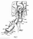 Fig. 09 - SYSTEMS AND METHODS FOR TREATING TISSUE WITH RADIOFREQUENCY ENERGY