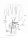 Fig. 01 - THERAPEUTIC SKIN LIFTING DEVICE AND RELATED SYSTEMS AND METHODS