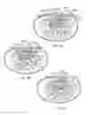 Fig. 05 - THERAPEUTIC SKIN LIFTING DEVICE AND RELATED SYSTEMS AND METHODS