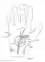Fig. 18 - THERAPEUTIC SKIN LIFTING DEVICE AND RELATED SYSTEMS AND METHODS