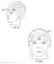 Fig. 20 - THERAPEUTIC SKIN LIFTING DEVICE AND RELATED SYSTEMS AND METHODS