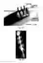 Fig. 04 - Apparatus and method for implantation of devices into soft tissue
