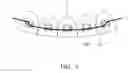 Fig. 05 - ORTHODONTIC  ASSEMBLY