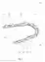 Fig. 04 - Teeth repositioning systems and methods