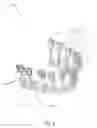 Fig. 12 - Teeth repositioning systems and methods