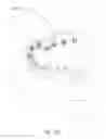 Fig. 17 - Teeth repositioning systems and methods