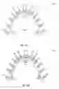 Fig. 27 - Teeth repositioning systems and methods