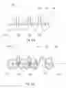Fig. 33 - Teeth repositioning systems and methods