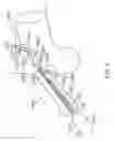 Fig. 03 - Urinary prosthesis systems