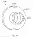 Fig. 10 - Urinary prosthesis systems