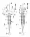 Fig. 23 - Storage assembly for prosthetic valve