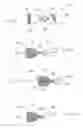 Fig. 02 - Bronchoscopic lung volume reduction valve