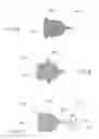 Fig. 03 - Bronchoscopic lung volume reduction valve
