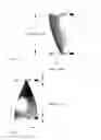 Fig. 03 - IMPLANTABLE FLOW DIVERTER