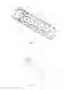 Fig. 06 - Thoracic aortic covered stent