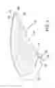 Fig. 05 - Ocular implant delivery system and method
