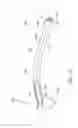 Fig. 14 - Ocular implant delivery system and method