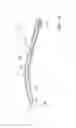Fig. 15 - Ocular implant delivery system and method