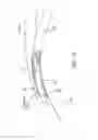 Fig. 17 - Ocular implant delivery system and method