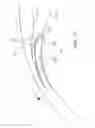 Fig. 19 - Ocular implant delivery system and method