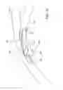 Fig. 20 - Ocular implant delivery system and method